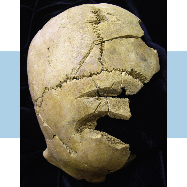 sk1756Balt Above: Skull after cleaning showing blade damage.